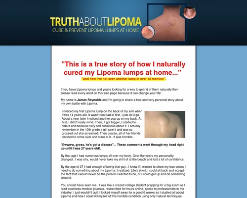 Original! – Truth About Lipoma. Excessive conversions + 75% fee!